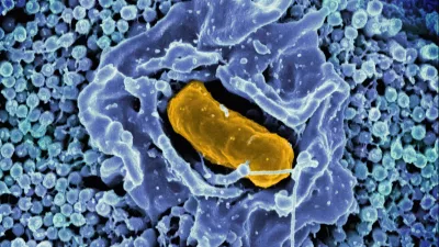 Electron micrograph of Salmonella Typhimurium invading a human epithelial cell